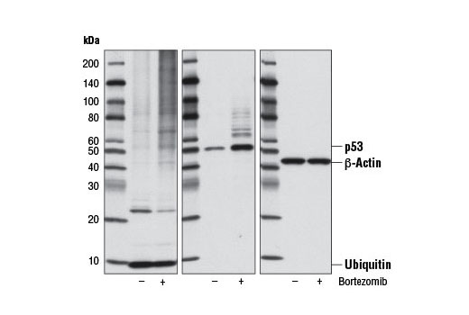 Western blot analysis of extracts from NIH/3T3 cells, untreated (-) or treated (+) with Bortezomib (100 nM, 6 hr), using Ubiquitin Antibody #3933 (left), p53 (1C12) Mouse mAb #2524 (middle), and β-Actin (13E5) Rabbit mAb #4970 (right).