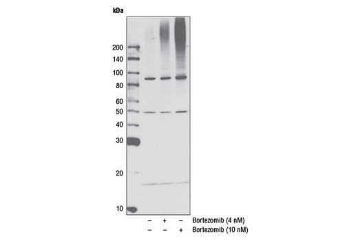 Western blot analysis of L363 cells, untreated (-) or treated (+) with Bortezomib (24 hr) as indicated, using K48-linkage Specific Polyubiquitin Antibody #4289.