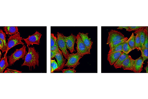 Confocal immunofluorescent analysis of MCF-7 cells, untreated (left) or treated with Brefeldin A for 1.5 hours at 100 ng/ml (middle) or 20 μg/ml (right), using a Golgin-97 antibody (green). Actin filaments have been labeled with DY-554 phalloidin (red). Blue pseudocolor = DRAQ5™ (fluorescent DNA dye).