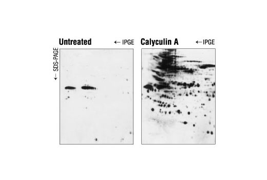 Western blot analysis of extracts from Jurkat cells, untreated or treated with Calyculin (0.1 µM for 45 minutes prior to lysis), using P-Thr-Polyclonal #9381. Proteins were separated by 2D electrophoresis prior to blotting.