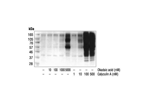 Western blot analysis of extracts from A431 cells treated with varied concentrations of Okadaic Acid or Calyculin A (30 minutes) using P-Thr-Polyclonal #9381.