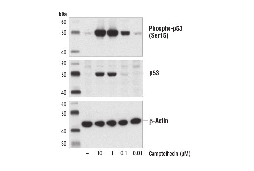 Western blot analysis of extracts from MCF7 cells, untreated (-) or treated with Camptothecin (6 hr) at the indicated concentrations, using Phospho-p53 (Ser15) Antibody #9284 (upper), p53 (1C12) Mouse mAb #2524 (middle), and β-Actin (D6A8) Rabbit mAb #8457 (lower).