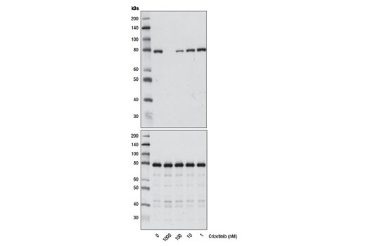 Western blot analysis of extracts from KARPAS-299 cells, untreated or treated with crizotinib (1 hr) at the indicated concentrations, using Phospho-ALK (Tyr1604) Antibody #3341 (upper) or ALK (D5F3) XP ® Rabbit mAb #3633 (lower).