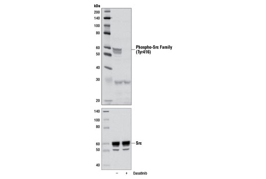 Western blot analysis of extracts from LNCaP cells, untreated (-) or treated with dasatinib (100 nM, 2 hr; +), using Phospho-Src Family (Tyr416) Antibody #2101 (upper) and Src (36D10) Rabbit mAb #2109 (lower).