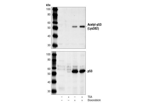 Western blot analysis of extracts from HeLa cells, untreated, treated with Doxorubicin (0.5 µM, 24 hr), or treated with Trichostatin A (TSA) #9950 (400 nM, 24 hr) and Doxorubicin (0.5 µM, 24 hr), using Acetyl-p53 (Lys382) Antibody #2525 (upper) or p53 (1C12) Mouse mAb #2524 (lower).