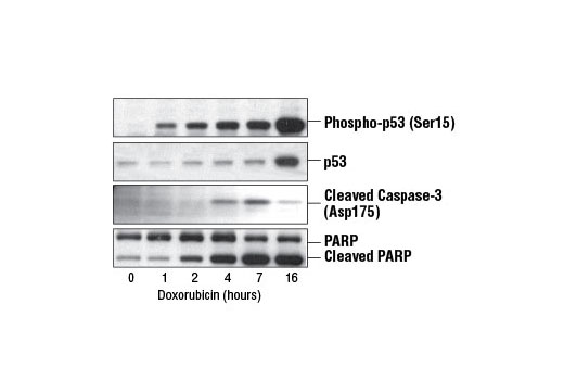 Western blot analysis of extracts from HeLa cells, serum-starved overnight and untreated or treated with Doxorubicin (5 μM) for the indicated times, using Phospho-p53 (Ser15) Antibody #9284, p53 Antibody #9282, Cleaved Caspase-3 (Asp175) Antibody #9661, or PARP Antibody #9542.