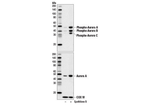 Western blot analysis of extracts from HeLa cells, untreated (-) or treated with Epothilone B (10 nM, 18 hr; +), using Phospho-Aurora A (Thr288)/Aurora B (Thr232)/Aurora C (Thr198) (D13A11) XP ® Rabbit mAb #2914 (upper) or Aurora A (1F8) Mouse mAb #12100 and COX IV (3E11) Rabbit mAb #4850 (lower).
