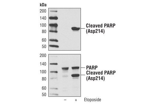 Western blot analysis of extracts from Jurkat cells, untreated (-) or etoposide-treated (25 μM, overnight; +), using Cleaved PARP (Asp214) (D64E10) XP ® Rabbit mAb #5625 (upper) or total PARP Antibody #9542 (lower).