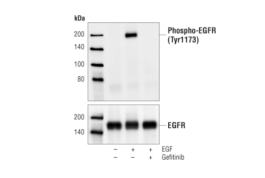 Western blot analysis of extracts from BxPC-3 cells, untreated or treated with EGF (100 ng/ml, 5 min) either with or without gefinitib pre-treatment (10 µM, 2 hr), using Phospho-EGF Receptor (Tyr1173) (53A5) Rabbit mAb #4407 (upper) or EGF Receptor Antibody #2232 (lower).