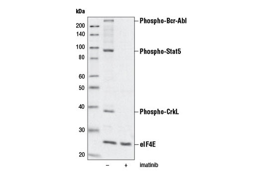 Western blot analysis of extracts from K-562 cells, untreated (-) or treated with imatinib (10 μM, 1 hr; +), using PathScan ® Bcr/Abl Activity Assay: Phospho-c-Abl, Phospho-Stat5 and Phospho-CrkL Multiplex Western Detection Cocktail #5300 to detect inhibition of phospho-Bcr-Abl, phospho-Stat5, and phospho-CrkL.