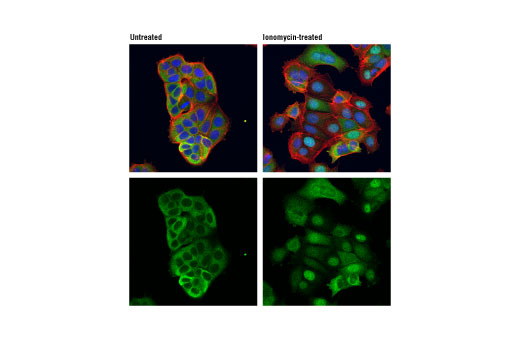 Confocal immunofluorescent analysis of MCF7 cells, untreated (left) or treated with Ionomycin (1 μM, 1 hr; right), using NFAT1 (D43B1) XP® Rabbit mAb #5861 (green). Actin filaments were labeled with DyLight™ 554 Phalloidin #13054 (red). Blue pseudocolor = DRAQ5® #4084 (fluorescent DNA dye).