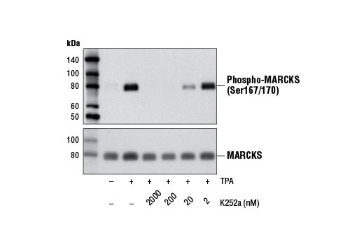 Western blot analysis of extracts from PC-12 cells, serum-starved overnight and untreated or treated with Human β-Nerve Growth Factor (hβ-NGF) #5221 (100 ng/ml, 5 min) either with or without K252a pretreatment (1 hr) at the indicated concentrations, using Phospho-TrkA (Tyr490) Antibody #9141 (upper) or β-Actin (D6A8) Rabbit mAb #8457 (lower).