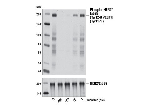 Western blot analysis of extracts from SK-BR-3 cells, untreated or treated with Lapatinib (6 hr) at the indicated concentrations, using Phospho-HER2/ErbB2 (Tyr1248)/EGFR (Tyr1173) Antibody #2244 (upper) or HER2/ErbB2 (D8F12) XP ® Rabbit mAb #4290 (lower).