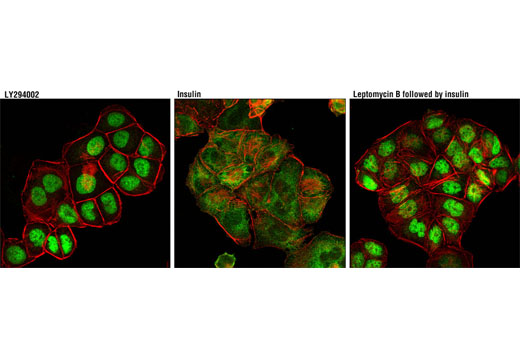 Confocal immunofluorescent analysis of IGROV-1 cells, treated with LY294002 #9901 (50 μM, 3hr; left), insulin (100 ng/mL, 30 min; middle), or Leptomycin B followed by insulin (20 nM, 3hr and 100 ng/mL, 30 min, respectively; right), using FoxO1 (C29H4) Rabbit mAb #2880 (green). Actin filaments were labeled with DY-554 phalloidin (red).