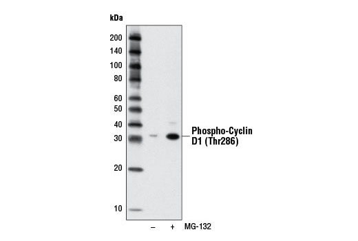 Western blot analysis of extracts from HT-1080 cells, untreated (-) or treated with MG-132 (10 μM, 4 hr; +), using Phospho-Cyclin D1 (Thr286) (D29B3) XP ® Rabbit mAb #3300.