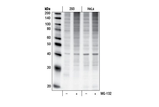 Western blot analysis of extracts from 293 and HeLa cells, untreated (-) or treated with MG-132 (50 µM, 90 min; +), using Ubiquitin (P4D1) Mouse mAb #3936.