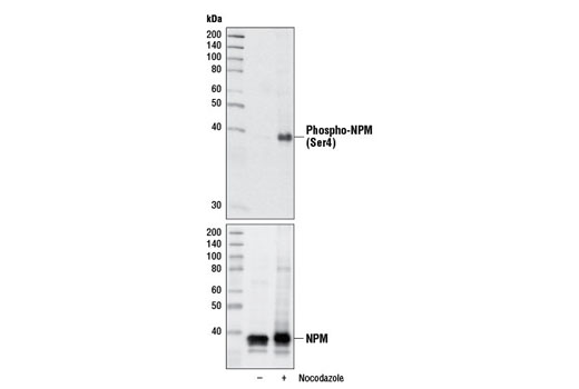 Western blot analysis of extracts from HeLa cells, untreated (-) or treated with Nocodazole (0.1 μg/ml, 18 hr; +), using Phospho-NPM (Ser4) (D19C1) XP ® Rabbit mAb #3520 (upper) or NPM Antibody #3542 (lower).