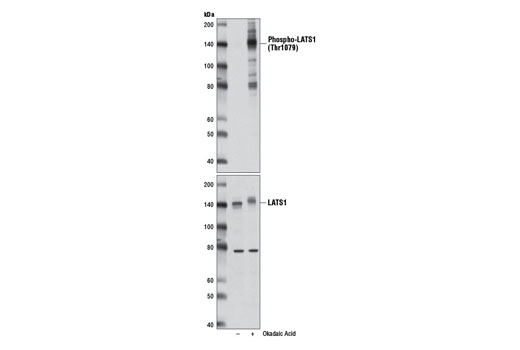 Western blot analysis of extracts from HeLa cells, untreated (-) or treated with Okadaic Acid (1 µM, 1 hr; +), using Phospho-LATS1 (Thr1079) (D57D3) Rabbit mAb #8654 (upper) or LATS1 (C66B5) Rabbit mAb #3477 (lower).