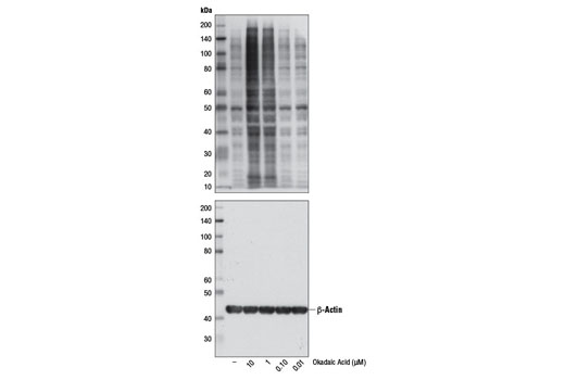 Western blot analysis of extracts from HeLa cells, untreated or treated with Okadaic Acid (1 hr) at the indicated concentrations, using Phospho-Threonine Antibody (P-Thr-Polyclonal) #9381 (upper) or β-Actin (D6A8) Rabbit mAb #8457 (lower).