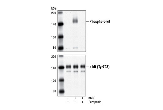 Western blot analysis of extracts from NCI-H526 cells, serum-starved overnight and untreated (-) or treated with Human Stem Cell Factor (hSCF) #8925 (100 ng/ml, 5 min; +) either with our without pazopanib pre-treatment (1 µM, 2 hr; +), using Phospho-c-Kit (Tyr703) (D12E12) Rabbit mAb #3073 (upper) or c-Kit (D13A2) XP ® Rabbit mAb #3074 (lower).
