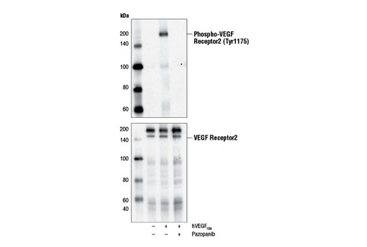 Western blot analysis of extracts from HUVE cells, serum-starved overnight and untreated (-) or treated with Human Vascular Endothelial Growth Factor (hVEGF 165 ) #8065 (50 ng/ml, 5 min; +) either with our without pazopanib pre-treatment (1 µM, 2 hr; +), using Phospho-VEGF Receptor 2 (Tyr1175) (19A10) Rabbit mAb #2478 (upper) or VEGF Receptor 2 (55B11) Rabbit mAb #2479 (lower).