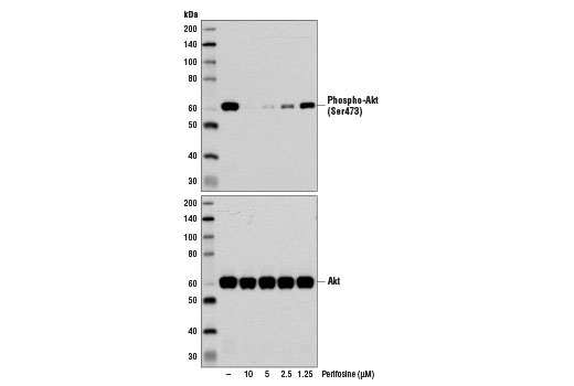 Western blot analysis of extracts from PC-3 cells, untreated (-) or treated with Perifosine (1 hr) at the indicated concentrations, using Phospho-Akt (Ser473) (D9E) XP ® Rabbit mAb #4060 (upper) or Akt (pan) (C67E7) Rabbit mAb #4691 (lower).