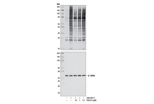 Western blot analysis of extracts from Jurkat cells, untreated or treated with Calyculin A #9902 (50 nM, 20 min) with or without pre-treatment with PKC412 (24 hr) for the indicated concentrations, using Phospho-(Ser) PKC Substrate Antibody #2261 (upper) and β-Actin (13E5) Rabbit mAb #4970 (lower).