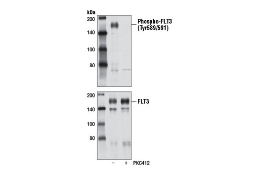 Western blot analysis of extracts from SEM cells, untreated (-) or treated with PKC412 (1 μM, 24 hr; +), using Phospho-FLT3 (Tyr589/591) (30D4) Rabbit mAb #3464 (upper) and FLT3 (8F2) Rabbit mAb #3462 (lower).