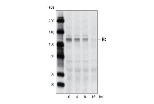 Western blot analysis of extracts from HeLa cells treated with Roscovitine (20 μM) for the indicated times using an antibody to Rb.