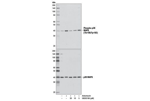 Western blot analysis of extracts from Jurkat cells, serum-starved overnight and pretreated with the indicated amounts of SB202190 for 1 hr, and subsequently treated with anisomycin (25 µg/ml, 30 min), using Phospho-p38 MAPK (Thr180/Tyr182) (D3F9) XP ® Rabbit mAb #4511 (upper) or p38 MAPK Antibody #9212 (lower).