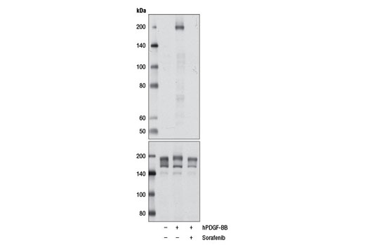Western blot analysis of extracts from NIH/3T3 cells, serum-starved overnight and untreated or treated with hPDGF-BB #8912 (100 ng/ml, 5 min) either with or without sorafenib pre-treatment (1 µM, 2 hr), using Phospho-PDGF Receptor β (Tyr1009) (42F9) Rabbit mAb #3124 (upper) or PDGF Receptor β (28E1) Rabbit mAb #3169 (lower).