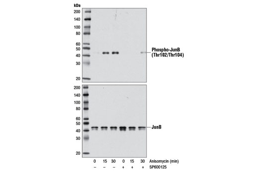 Western blot analysis of extracts from 293T cells, untreated or treated with anisomycin (25 μg/ml) for the indicated times either with or without SP600125 pre-treatment (50 μM, 40 min), using Phospho-JunB (Thr102/Thr104) (D3C6) Rabbit mAb #8053 (upper) or JunB (C37F9) Rabbit mAb #3753 (lower).