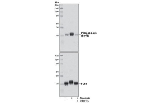 Western blot analysis of extracts from 293T cells, untreated or treated with anisomycin (25 μg/ml, 15 min) either with or without SP600125 pre-treatment (50 μM, 40 min), using Phospho-c-Jun (Ser73) (D47G9) XP ® Rabbit mAb #3270 (upper) or c-Jun (60A8) Rabbit mAb #9165 (lower).