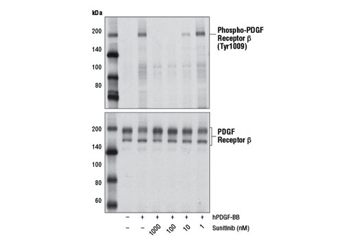 Western blot analysis of extracts from NIH/3T3 cells, serum-starved overnight and untreated or treated with hPDGF-BB #8912 (100 ng/ml, 5 min) either with or without Sunitinib pre-treatment (2 hr) at the indicated concentrations, using Phospho-PDGF Receptor β (Tyr1009) (42F9) Rabbit mAb #3124 (upper) or PDGF Receptor β (28E1) Rabbit mAb #3169 (lower).