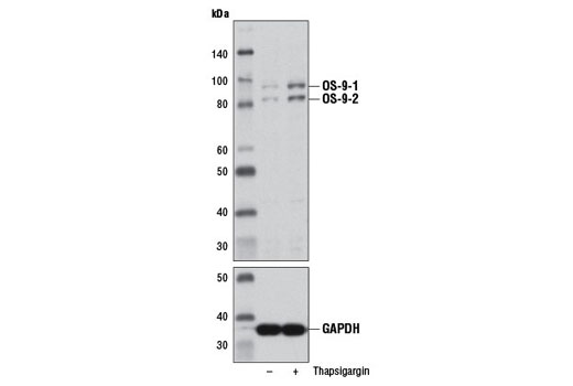 Western blot analysis of extracts from HeLa cells, untreated (-) or treated with Thapsigargin (2 nM, 16 hr; +), using OS-9 (D8P4G) Rabbit mAb #12497 (upper) and GAPDH (D16H11) XP ® Rabbit mAb #5174 (lower).