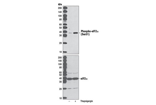Western blot analysis of extracts from C2C12 cells, untreated (-) or treated with Thapsigargin (300 nM, 30 min; +), using Phospho-eIF2α (Ser51) (D9G8) XP ® Rabbit mAb #3398 (upper) and eIF2α Antibody #9722 (lower).