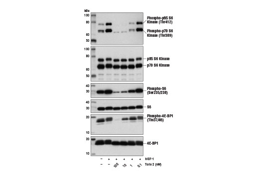 Western blot analysis of extracts from MCF7 cells, serum-starved overnight and untreated (-) or treated with hIGF-I #8917 (100 ng/ml, 10 min; +), either with or without Torin 2 pretreatment (1 hr) at the indicated concentrations, using Phospho-p70 S6 Kinase (Thr389) (108D2) Rabbit mAb #9234, p70 S6 Kinase (49D7) Rabbit mAb #2708, Phospho-S6 Ribosomal Protein (Ser235/236) (D57.2.2E) XP ® Rabbit mAb #4858, S6 Ribosomal Protein (5G10) Rabbit mAb #2217, Phospho-4E-BP1 (Thr37/46) (236B4) Rabbit mAb #2855, and 4E-BP1 Antibody #9452.