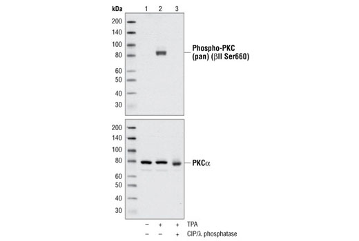 Western blot analysis of extracts from serum-starved 293 cells, untreated (lane 1), stimulated with TPA treatment (lanes 2 & 3), and treated with CIP and λ phosphatase (lane 3), using Phospho-PKC (pan) (βII Ser660) Antibody #9371 or PKCα Antibody #2056.