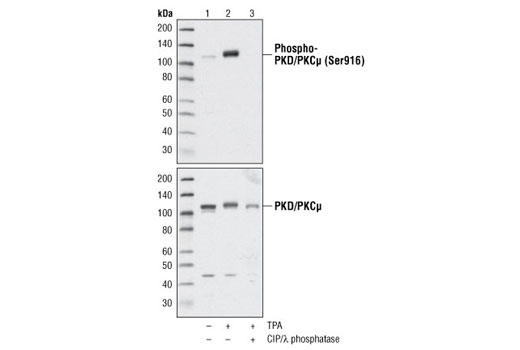 Western blot analysis of extracts from serum-starved 293 cells, untreated (lane 1), stimulated with TPA treatment (lanes 2 & 3), and treated with CIP and λ phosphatase (lane 3), using Phospho-PKD/PKCμ (Ser916) Antibody #2051 or PKD/PKCμ Antibody #2052.