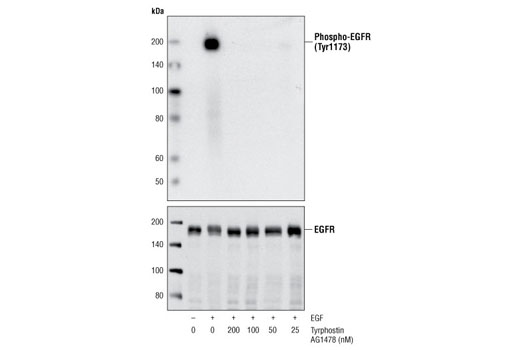 Western blot analysis of extracts from serum starved A431 cells, untreated or treated with indicated concentrations of Tyrphostin AG1478 for 30 minutes, followed by stimulation with EGF for 10 minutes. The EGFR activation was detected by using Phospho-EGF Receptor (Tyr1173) (53A5) Rabbit mAb #4407 (upper). EGF Receptor Antibody #2232 was used to detect the equal loading of EGFR (lower). Tyrphostin AG1478-mediated inhibition of EGF-induced phosphorylation of EGF Receptor at Tyr1173 is shown.