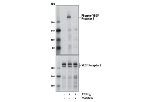 Western blot analysis of extracts from HUVE cells serum-starved overnight, untreated (-) or pre-treated with Vandetanib (5 µM, 2 hr; +) and treated with Human Vascular Endothelial Growth Factor-165 (hVEGF 165 ) #8065 (50 ng/ml, 5 min; +) as indicated, using Phospho-VEGF Receptor 2 (Tyr1175) (19A10) Rabbit mAb #2478 (upper) or VEGF Receptor 2 (55B11) Rabbit mAb #2479 (lower).
