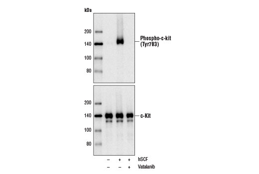 Western blot analysis of extracts from NCI-H526 cells, serum-starved overnight and untreated (-) or pretreated with Vatalanib (1000 nM, 2 hr; +) prior to treatment with Human Stem Cell Factor (hSCF) #8925 (100 ng/ml, 5 min; +), using Phospho-c-Kit (Tyr703) (D12E12) Rabbit mAb #3073 (upper) or c-Kit (D13A2) XP ® Rabbit mAb #3074 (lower).