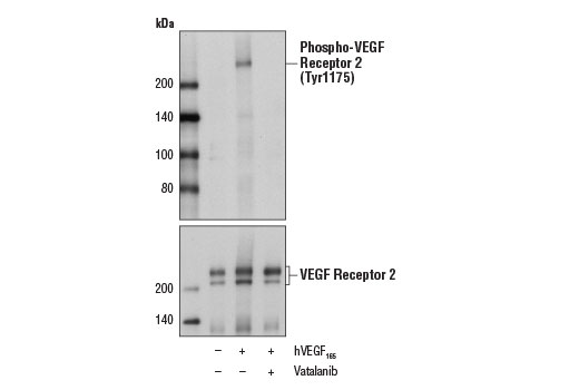 Western blot analysis of extracts from HUVE cells, serum-starved overnight and untreated (-) or pretreated with Vatalanib (1000 nM, 2 hr; +) prior to treatment with Human Vascular Endothelial Growth Factor-165 (hVEGF 165 ) #8065 (50 ng/ml, 5 min; +), using Phospho-VEGF Receptor 2 (Tyr1175) (19A10) Rabbit mAb #2478 (upper) or VEGF Receptor 2 (55B11) Rabbit mAb #2479 (lower).