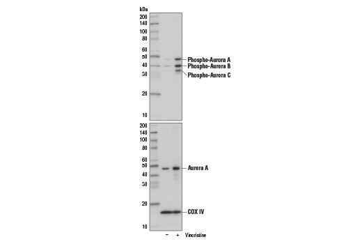 Western blot analysis of extracts from HeLa cells, untreated (-) or treated with Vincristine (10 nM, 18 hr; +), using Phospho-Aurora A (Thr288)/Aurora B (Thr232)/Aurora C (Thr198) (D13A11) XP ® Rabbit mAb #2914 (upper) or Aurora A (1F8) Mouse mAb #12100 and COX IV (3E11) Rabbit mAb #4850 (lower).