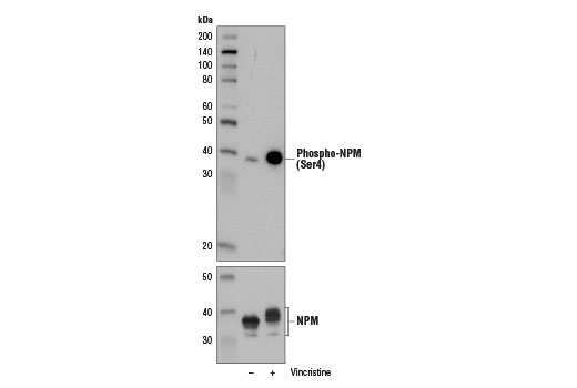 Western blot analysis of extracts from HeLa cells, untreated (-) or treated with Vincristine (10 nM, 18 hr; +), using Phospho-NPM (Ser4) (D19C1) XP ® Rabbit mAb #3520 (upper) or NPM Antibody #3542 (lower).