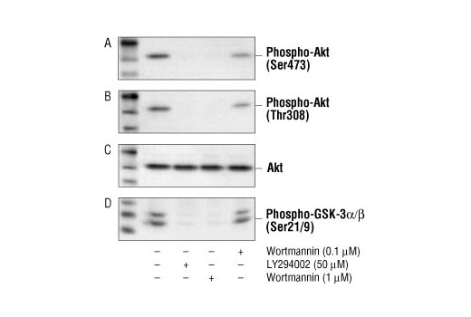 Western blot analysis of extracts from untreated, wortmannin and/or LY294002 treated Jurkat cells, using Phospho-Akt (Ser473) Antibody #9271 (A), Phospho-Akt (Thr308) Antibody #9275 (B), Akt Antibody #9272 (C) and Phospho-GSK-3alpha/beta (Ser21/9) Antibody #9331 (D).