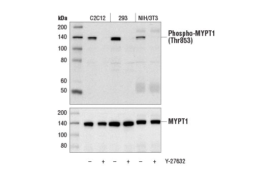 Western blot analysis of extracts from C2C12, 293, and NIH/3T3 cells, untreated (-) or treated with Y-27632 (10 μM, 1 hr; +), using Phospho-MYPT1 (Thr853) Antibody #4563 (upper) and MYPT1 Antibody #2634 (lower).