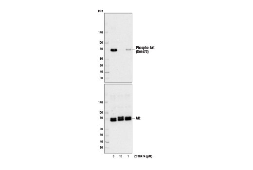 Western blot analysis of extracts from Jurkat cells, untreated or treated with ZSTK474 (24 hr) at the indicated concentrations, using Phospho-Akt (Ser473) (D9E) XP ® Rabbit mAb #4060 (upper) or Akt (pan) (C67E7) Rabbit mAb #4691 (lower).