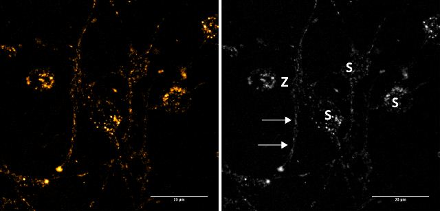  Figure 2a: Images in the first row show a group of neuronal cells stained with 50 μM FFN102 (sum projection of a confocal stack). FFN102 localizes to structures on the cell soma (S) as well as neurites (arrows). Z indicates the area zoomed in for an additional z-stack.