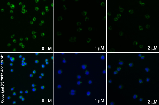  ab32518 staining IkBα/β in RAW 264.7 cells treated with FK506 (ab120223), by ICC/IF. Decrease in IkBα/&beta expression correlates with increased concentration of FK506, as described in literature.The cells were incubated at 37°C for 3h in media containing different concentrations of ab120223 (FK506) in DMSO, fixed with 100% methanol for 5 minutes at -20°C and blocked with PBS containing 10% goat serum, 0.3 M glycine, 1% BSA and 0.1% tween for 2h at room temperature. Staining of the treated cells with ab32518 (1/100 dilution) was performed overnight at 4°C in PBS containing 1% BSA and 0.1% tween. A DyLight 488 goat anti-rabbit polyclonal antibody (ab96899) at 1/250 dilution was used as the secondary antibody. Nuclei were counterstained with DAPI and are shown in blue.